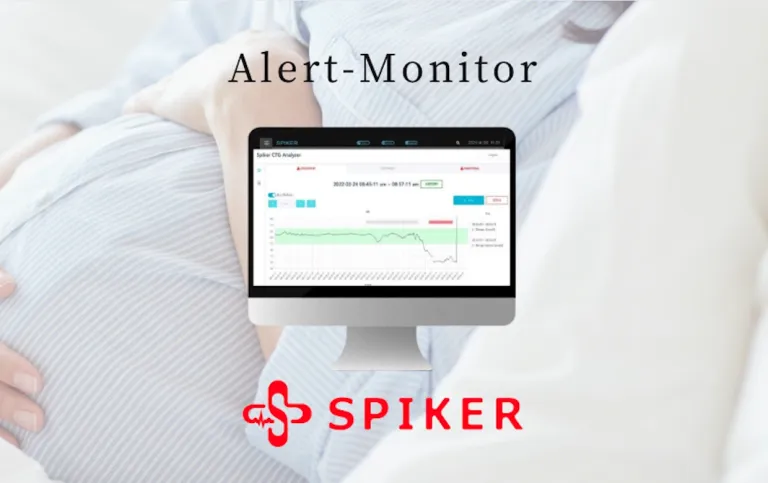 出産時の赤ちゃんの心拍を見守るAIを開発、spikerが8,300万円をプレシリーズA調達——アフリカでの販売準備に着手